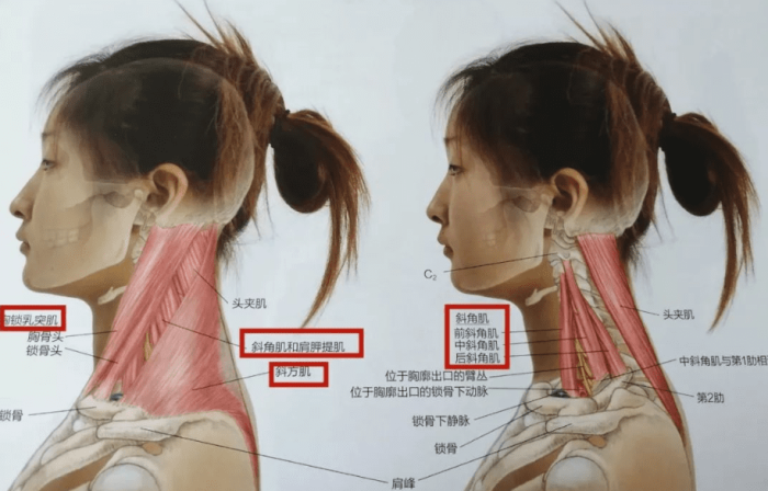 落枕的自我診斷 落枕的自我診斷